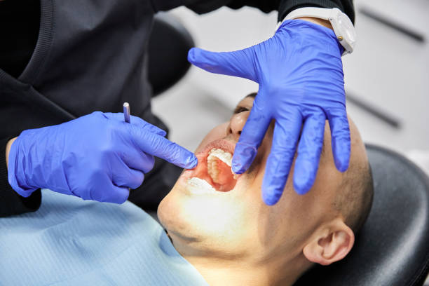 Best Emergency Broken Tooth Repair in Dodson Branch, TN