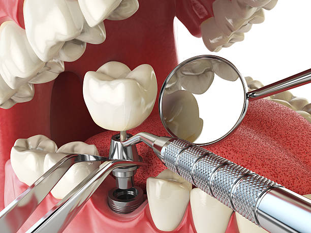 Best Emergency Orthodontic Repairs in Dodson Branch, TN